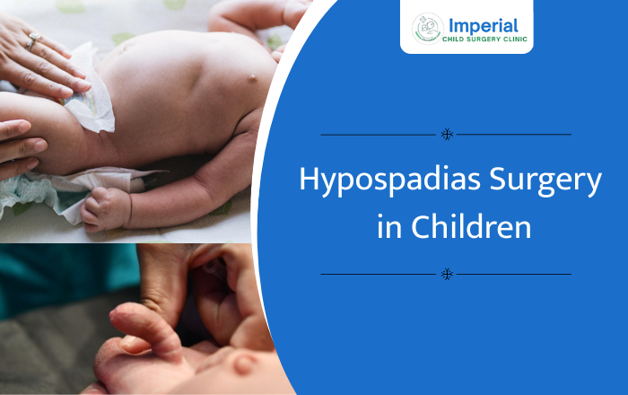 Hypospadias Surgery in Children: What Every Parent Needs to Know