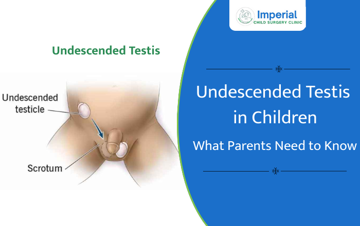 Undescended Testis in Children: What Parents Need to Know