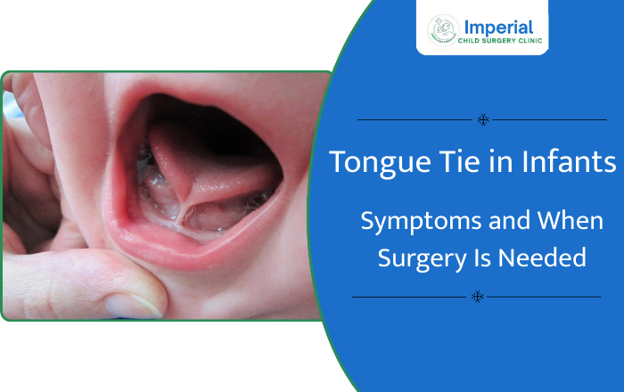 Tongue Tie in Infants: Symptoms and When Surgery Is Needed